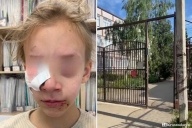Разорвала девочке лицо