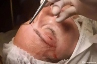 Червь в глазу
