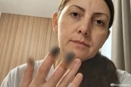 Некроз тканей
